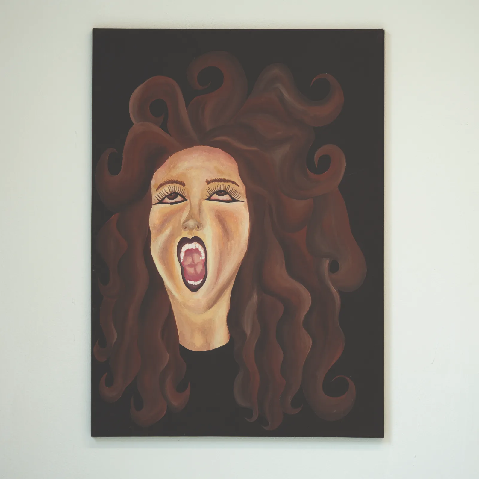 study: "attractiveness of women with rectovaginal endometriosis" by Ann Brunnschweiler